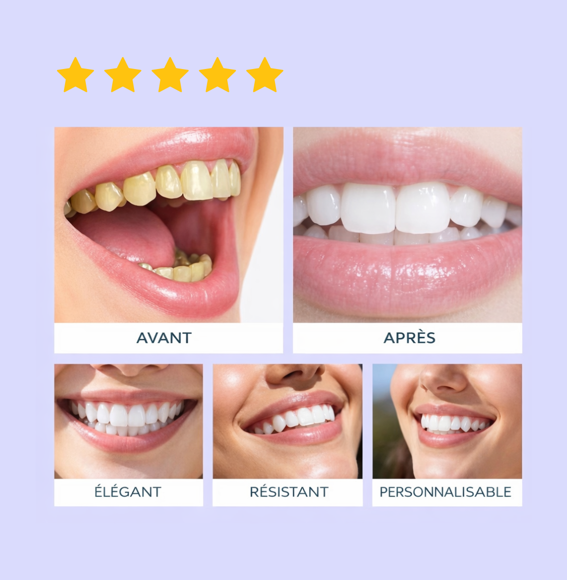 🦷 Bandes Blanchissantes Violettes – Blancheur Instantanée